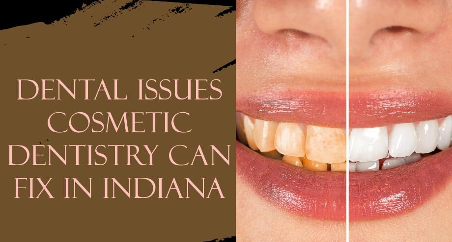 9 Dental Issues Cosmetic Dentistry Can Fix in Indiana