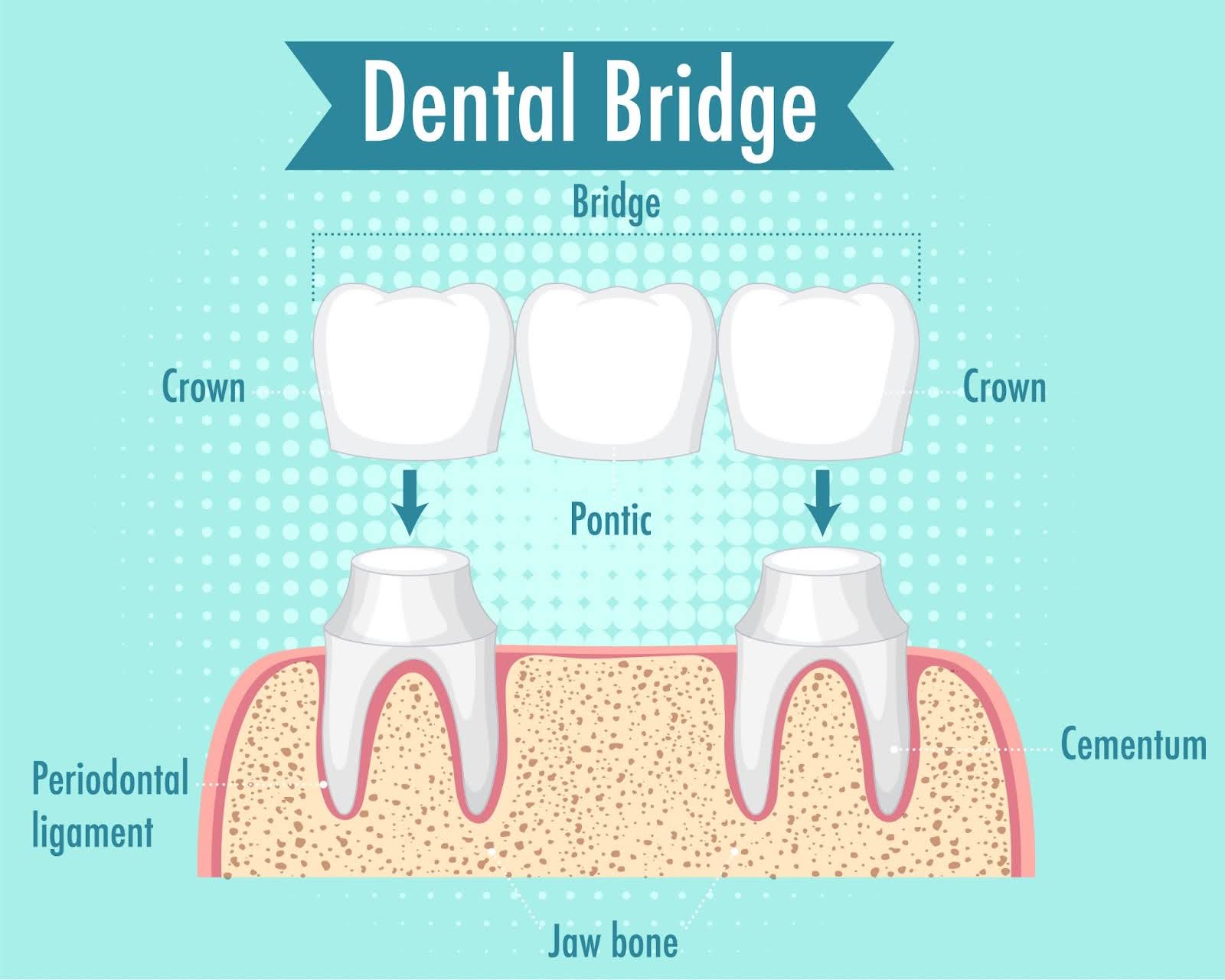 Emergency Dental Care
