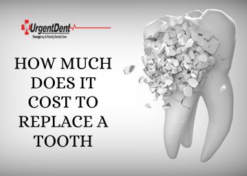 How Much Does it Cost to Replace a Tooth?