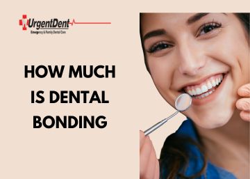 How Much is Dental Bonding? Understanding the Costs and Benefits