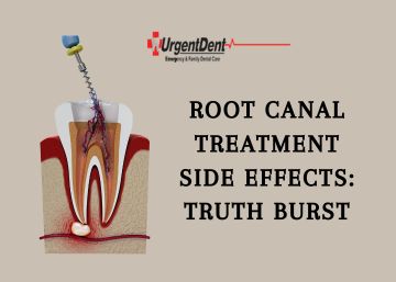 Root Canal Treatment Side Effects: Truth Burst